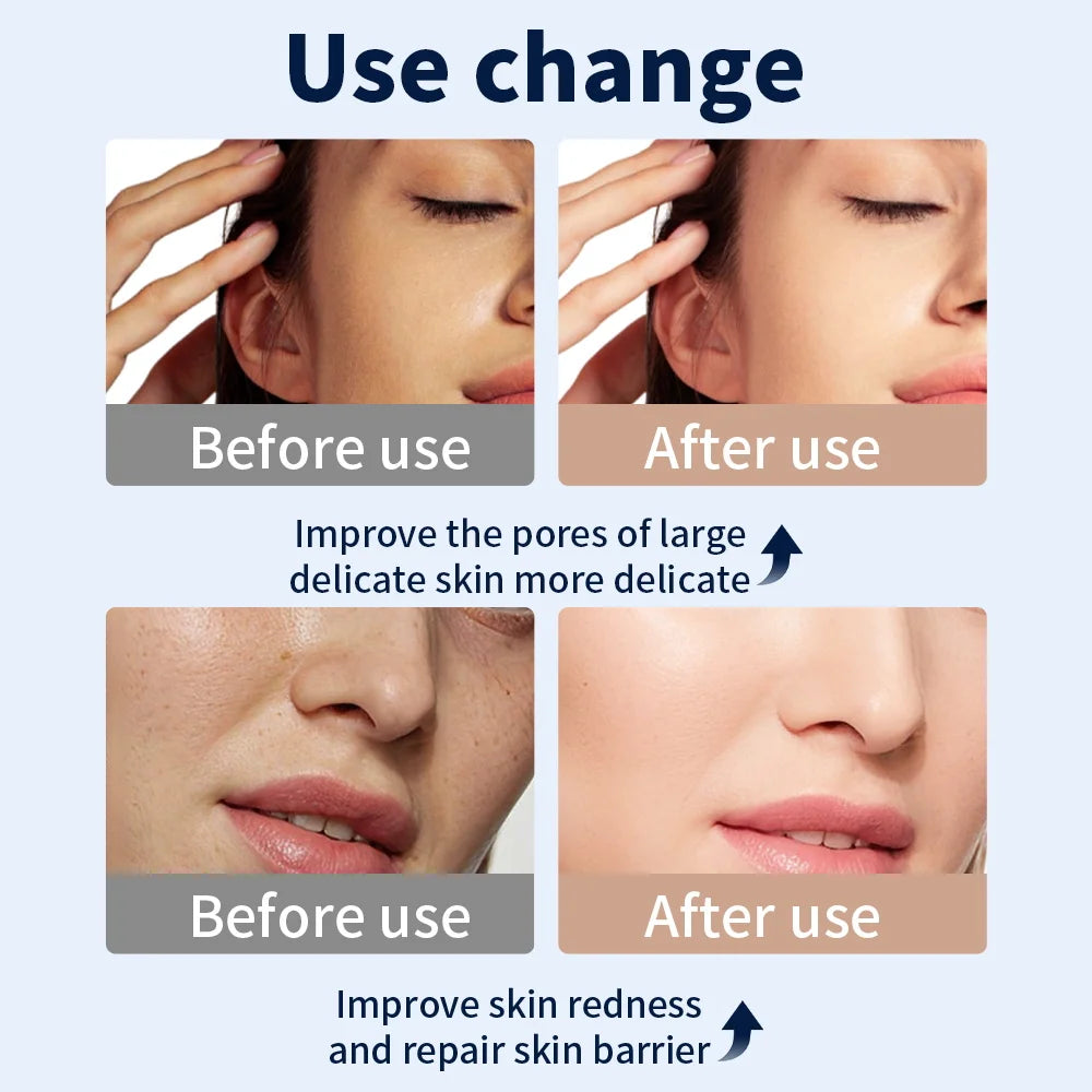 A before-and-after using the LumiLift™ Red Light Therapy Silicone Face Mask shows reduced redness, visibly refined pores, and smoother, clearer skin on a woman’s cheek.