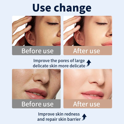 A before-and-after using the LumiLift™ Red Light Therapy Silicone Face Mask shows reduced redness, visibly refined pores, and smoother, clearer skin on a woman’s cheek.