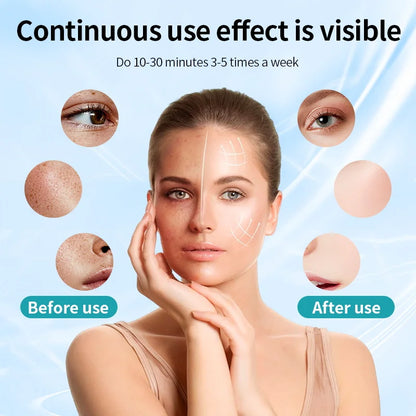 A woman touches her face, with before and after images showing improved skin texture and fewer spots from using the LumiLift™ Red Light Therapy Silicone Face Mask. Visible results with continuous use: 10–30 minutes, 3–5 times a week.